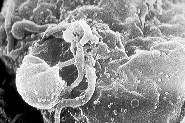HIV virus.